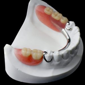 Denture