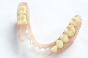 Removable Denture